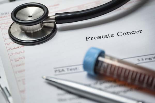 New research shows little risk of infection from prostate biopsies